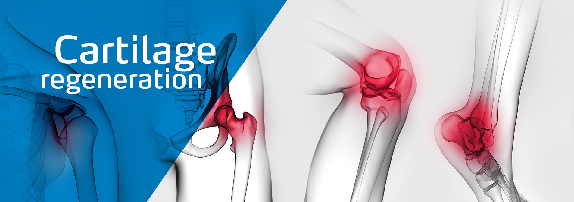 meidrix header image: cartilage regeneration